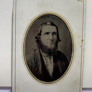 1880’s Skull Base Tumor On Mans Head Medical Daguerreotype photograph Golf Ball!